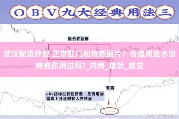 武汉配资炒股 正常肛门和痔疮图片？合理用盐水治痔疮你用过吗?_内痔_症状_感觉